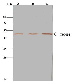 TSG101 Antibody - TSG101 was immunoprecipitated using: Lane A: 0.5 mg Jurkat Whole Cell Lysate. Lane B: 0.5 mg Hela Whole Cell Lysate. Lane C:0.5 mg HepG2 Whole Cell Lysate. 1 uL anti-TSG101 rabbit polyclonal antibody and 15 ul of 50% Protein G agarose. Primary antibody: Anti-TSG101 rabbit polyclonal antibody, at 1:500 dilution. Secondary antibody: Clean-Blot IP Detection Reagent (HRP) at 1:500 dilution. Developed using the DAB staining technique. Performed under reducing conditions. Predicted band size: 44 kDa. Observed band size: 44 kDa.