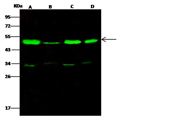 TSG101 Antibody - Anti-TSG101 rabbit polyclonal antibody at 1:500 dilution. Lane A: HeLa Whole Cell Lysate. Lane B: A431 Whole Cell Lysate. Lane C: Jurkat Whole Cell Lysate. Lane D: HepG2 Whole Cell Lysate. Lysates/proteins at 30 ug per lane. Secondary: Goat Anti-Rabbit IgG H&L (Dylight 800) at 1/10000 dilution. Developed using the Odyssey technique. Performed under reducing conditions. Predicted band size: 43 kDa. Observed band size: 49 kDa. (We are unsure as to the identity of these extra bands.)