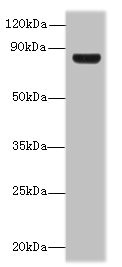 TSGA10 Antibody - Western blot All lanes: TSGA10 antibody at 1.5µg/ml + U251 whole cell lysate Secondary Goat polyclonal to rabbit IgG at 1/10000 dilution Predicted band size: 82, 35 kDa Observed band size: 82 kDa