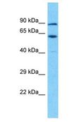 TSGA10IP Antibody - TSGA10IP antibody Western Blot of OVCAR-3. Antibody dilution: 1 ug/ml.  This image was taken for the unconjugated form of this product. Other forms have not been tested.