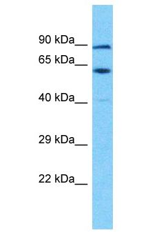 TSGA10IP Antibody - TSGA10IP antibody Western Blot of OVCAR-3. Antibody dilution: 1 ug/ml.  This image was taken for the unconjugated form of this product. Other forms have not been tested.