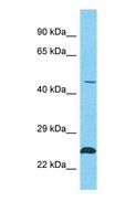 TSGA10IP Antibody - Western blot of TSGA10IP Antibody with human HT1080 Whole Cell lysate.  This image was taken for the unconjugated form of this product. Other forms have not been tested.