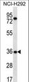 TSGA13 Antibody - TSGA13 Antibody western blot of NCI-H292 cell line lysates (35 ug/lane). The TSGA13 antibody detected the TSGA13 protein (arrow).