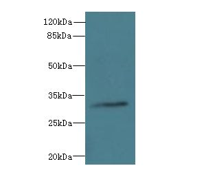 TSGA13 Antibody - Western blot. All lanes: TSGA13 antibody at 4 ug/ml+A549 whole cell lysate Goat polyclonal to rabbit at 1:10000 dilution. Predicted band size: 32 kDa. Observed band size: 32 kDa.