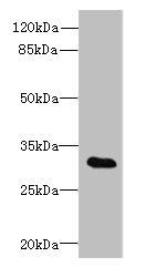 TSGA13 Antibody - Western blot All lanes: TSGA13 antibody at 4µg/ml + A549 whole cell lysate Secondary Goat polyclonal to rabbit IgG at 1/10000 dilution Predicted band size: 32 kDa Observed band size: 32 kDa