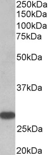 TSH Receptor / TSHR Antibody - TSHR antibody (0.5 ug/ml) staining of Human Thyroid gland lysate (35 ug protein in RIPA buffer). Primary incubation was 1 hour. Detected by chemiluminescence.
