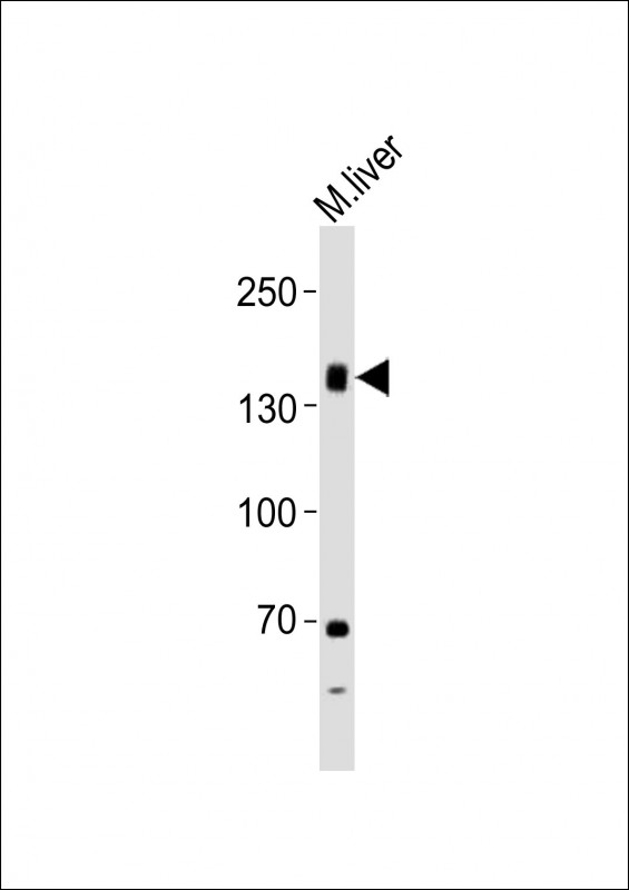TSH Receptor / TSHR Antibody - Anti-TSHR Antibody at 1:1000 dilution + mouse liver lysates Lysates/proteins at 20 ug per lane. Secondary Goat Anti-Rabbit IgG, (H+L), Peroxidase conjugated at 1/10000 dilution Predicted band size : 87 kDa Blocking/Dilution buffer: 5% NFDM/TBST.