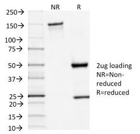 TSH Receptor / TSHR Antibody - SDS-PAGE Analysis of Purified, BSA-Free TSHR Antibody (clone TSHRA/1402). Confirmation of Integrity and Purity of the Antibody.