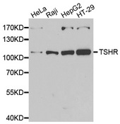 TSH Receptor / TSHR Antibody - Western blot analysis of extracts of various cell lines.