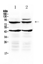 TSH Receptor / TSHR Antibody - Western blot - Anti-TSH Receptor Picoband Antibody