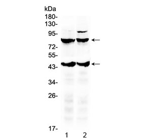 TSH Receptor / TSHR Antibody - Western blot testing of 1) rat brain and 2) mouse brain lysate with TSH Receptor antibody. Predicted molecular weight ~87 kDa (full length), ~44 kDa (beta subunit).