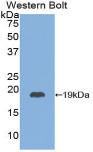 TSHB / TSH-Beta Antibody - Western blot of recombinant TSHB / TSH-Beta.  This image was taken for the unconjugated form of this product. Other forms have not been tested.