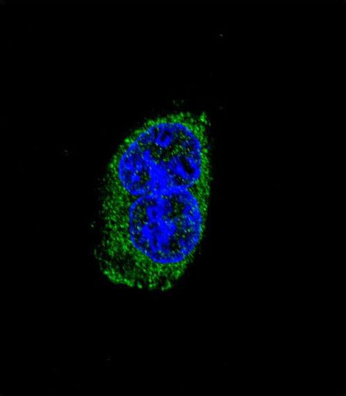 TSHB / TSH-Beta Antibody - Confocal immunofluorescence of TSHB Antibody with MDA-MB231 cell followed by Alexa Fluor 488-conjugated goat anti-rabbit lgG (green). DAPI was used to stain the cell nuclear (blue).