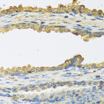 TSHB / TSH-Beta Antibody - Immunohistochemistry of paraffin-embedded human prostate.