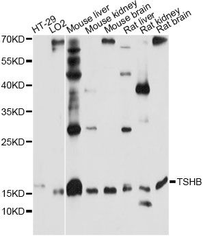 TSHB / TSH-Beta Antibody - Western blot analysis of extracts of various cell lines, using TSHB antibody at 1:1000 dilution. The secondary antibody used was an HRP Goat Anti-Rabbit IgG (H+L) at 1:10000 dilution. Lysates were loaded 25ug per lane and 3% nonfat dry milk in TBST was used for blocking. An ECL Kit was used for detection and the exposure time was 10s.
