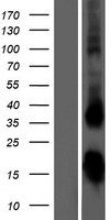 TSHB / TSH-Beta Protein - Western validation with an anti-DDK antibody * L: Control HEK293 lysate R: Over-expression lysate