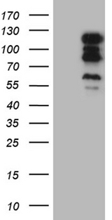TSHZ1 Antibody - HEK293T cells were transfected with the pCMV6-ENTRY control. (Left lane) or pCMV6-ENTRY TSHZ1. (Right lane) cDNA for 48 hrs and lysed. Equivalent amounts of cell lysates. (5 ug per lane) were separated by SDS-PAGE and immunoblotted with anti-TSHZ1. (1:2000)
