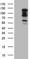 TSHZ1 Antibody - HEK293T cells were transfected with the pCMV6-ENTRY control. (Left lane) or pCMV6-ENTRY TSHZ1. (Right lane) cDNA for 48 hrs and lysed