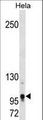 TSHZ1 Antibody - Mouse Tshz1 Antibody western blot of HeLa cell line lysates (35 ug/lane). The Mouse Tshz1 antibody detected the Mouse Tshz1 protein (arrow).