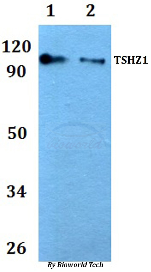 TSHZ1 Antibody - Western blot of TSHZ1 antibody at 1:500 dilution. Lane 1: HEK293T whole cell lysate. Lane 2: RAW264.7 whole cell lysate.