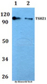 TSHZ1 Antibody - Western blot of TSHZ1 antibody at 1:500 dilution. Lane 1: HEK293T whole cell lysate. Lane 2: RAW264.7 whole cell lysate.