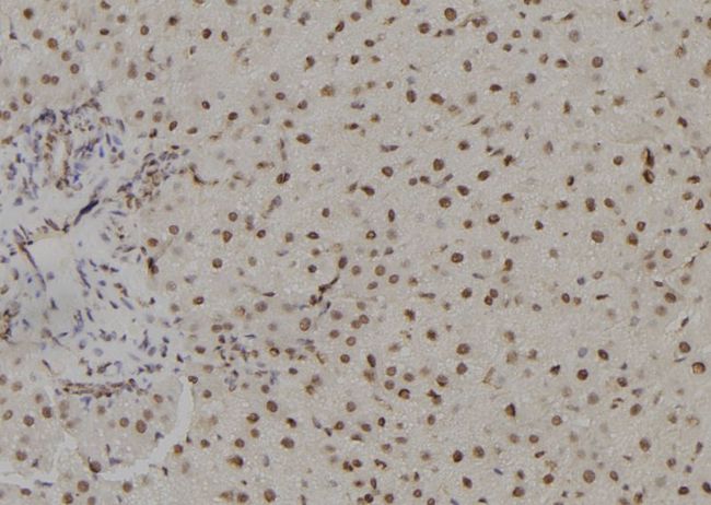 TSHZ1 Antibody - 1:100 staining rat liver tissue by IHC-P. The sample was formaldehyde fixed and a heat mediated antigen retrieval step in citrate buffer was performed. The sample was then blocked and incubated with the antibody for 1.5 hours at 22°C. An HRP conjugated goat anti-rabbit antibody was used as the secondary.