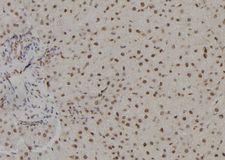 TSHZ1 Antibody - 1:100 staining rat liver tissue by IHC-P. The sample was formaldehyde fixed and a heat mediated antigen retrieval step in citrate buffer was performed. The sample was then blocked and incubated with the antibody for 1.5 hours at 22°C. An HRP conjugated goat anti-rabbit antibody was used as the secondary.