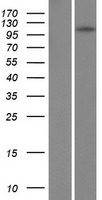 TSHZ1 Protein - Western validation with an anti-DDK antibody * L: Control HEK293 lysate R: Over-expression lysate