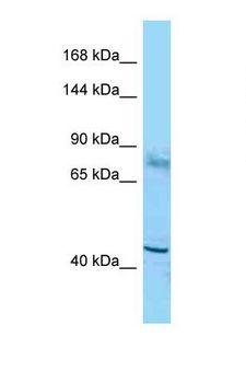 TSHZ2 Antibody - Western blot of Mouse Liver. Tshz2 antibody dilution 1.0 ug/ml.  This image was taken for the unconjugated form of this product. Other forms have not been tested.