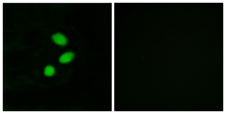 TSHZ2 Antibody - Immunofluorescence analysis of MCF7 cells, using TSH2 Antibody. The picture on the right is blocked with the synthesized peptide.