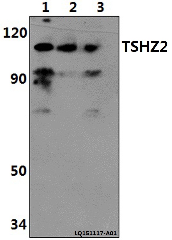 TSHZ2 Antibody - Western blot of TSHZ2 polyclonal antibody at 1:500 dilution. Lane 1: HeLa whole cell lysate (40 ug). Lane 2: The Heart tissue lysate of Rat(30 ug). Lane 3: The Heart tissue lysate of Mouse(30 ug).