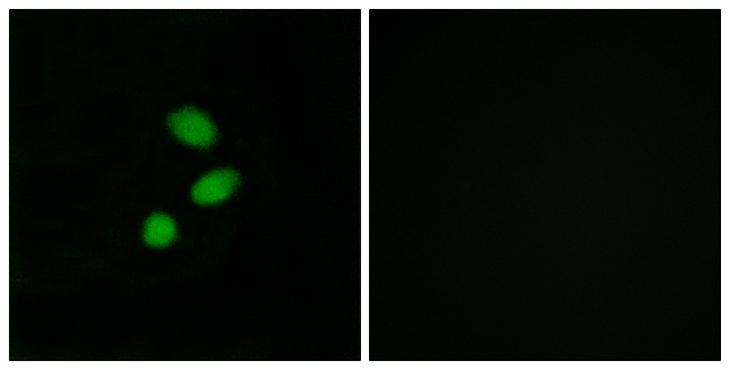 TSHZ2 Antibody - Peptide - + Immunofluorescence analysis of MCF-7 cells, using TSH2 antibody.