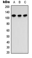 TSHZ3 Antibody - Western blot analysis of TSHZ3 expression in MCF7 (A); Raw264.7 (B); PC12 (C) whole cell lysates.