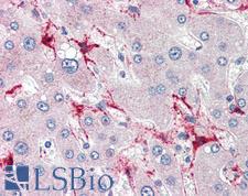 TSKS Antibody - Anti-TSKS antibody IHC of human liver. Immunohistochemistry of formalin-fixed, paraffin-embedded tissue after heat-induced antigen retrieval. Antibody concentration 5 ug/ml.  This image was taken for the unconjugated form of this product. Other forms have not been tested.