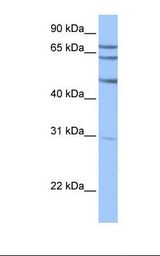 TSKS Antibody - HepG2 cell lysate. Antibody concentration: 1.0 ug/ml. Gel concentration: 12%.  This image was taken for the unconjugated form of this product. Other forms have not been tested.