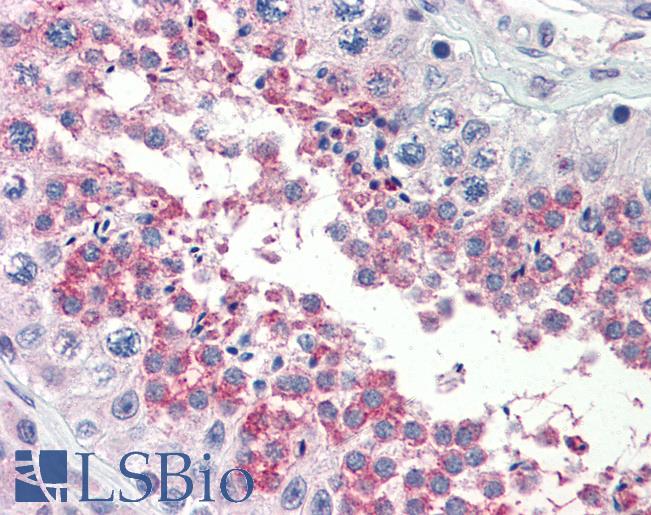 TSKS Antibody - Anti-TSKS antibody IHC of human testis. Immunohistochemistry of formalin-fixed, paraffin-embedded tissue after heat-induced antigen retrieval. Antibody concentration 5 ug/ml.  This image was taken for the unconjugated form of this product. Other forms have not been tested.