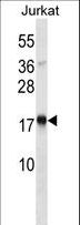 TSLP Antibody - TSLP Antibody western blot of Jurkat cell line lysates (35 ug/lane). The TSLP antibody detected the TSLP protein (arrow).