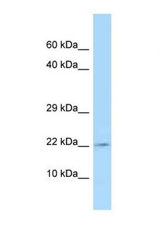 TSLP Antibody - TSLP antibody Western blot of MCF7 Cell lysate. Antibody concentration 1 ug/ml.  This image was taken for the unconjugated form of this product. Other forms have not been tested.