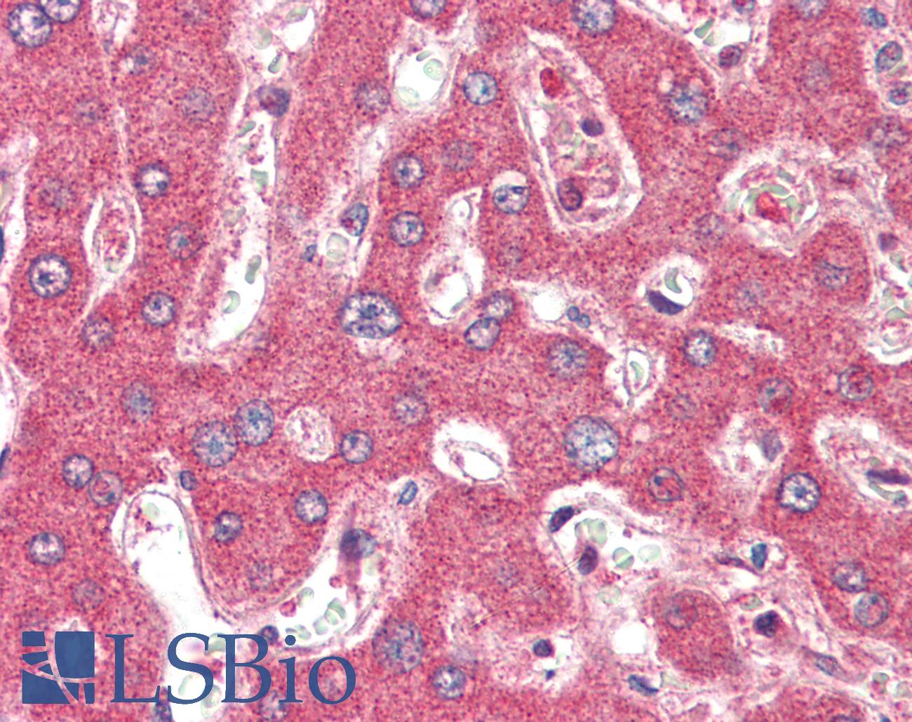 Anti-TSLP Antibody | Rabbit Anti-Human Polyclonal ELISA,IF,IHC,WB | LSBio