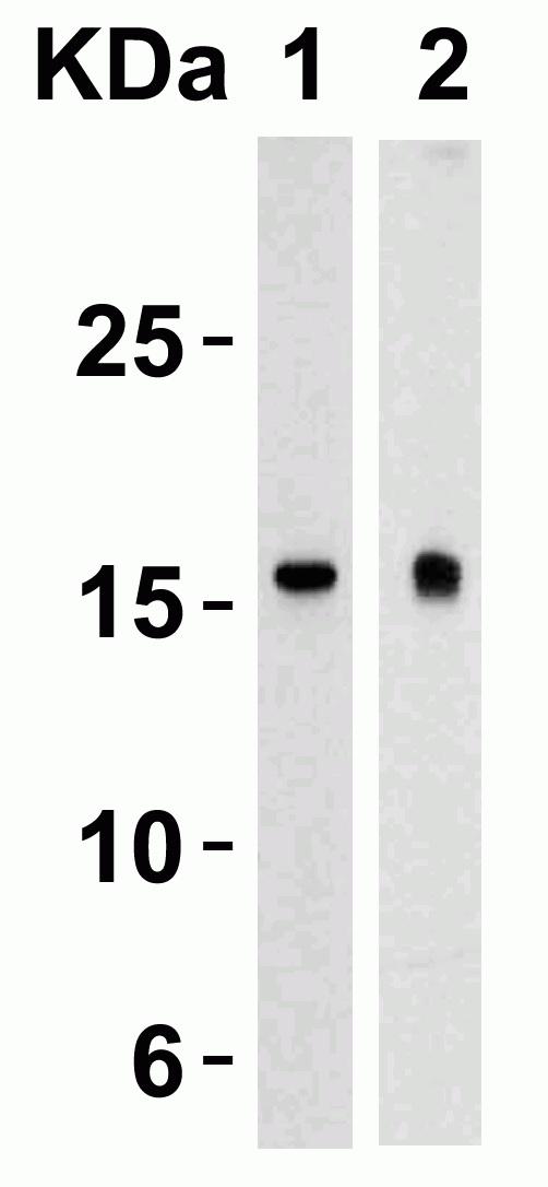TSLP Antibody - Western Blot validation in Human Heart (Lane 1) and Human Prostate (Lane 2). Loading: 15 µg of lysates per lane. Antibodies: LS-B3208 (4 µg/ml), 1h incubation at RT in 5% NFDM/TBST. Secondary: Goat anti-rabbit IgG HRP conjugate at 1:10,000 dilution.