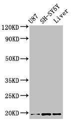 TSLP Antibody - Western Blot Positive WB detected in: U87 whole cell lysate, SH-SY5Y whole cell lysate, Mouse liver tissue All lanes: TSLP antibody at 3.4µg/ml Secondary Goat polyclonal to rabbit IgG at 1/50000 dilution Predicted band size: 19, 8 kDa Observed band size: 19 kDa