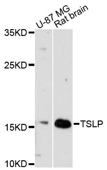TSLP Antibody - Western blot analysis of extracts of various cell lines, using TSLP antibody at 1:3000 dilution. The secondary antibody used was an HRP Goat Anti-Rabbit IgG (H+L) at 1:10000 dilution. Lysates were loaded 25ug per lane and 3% nonfat dry milk in TBST was used for blocking. An ECL Kit was used for detection and the exposure time was 90s.