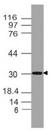 TSLP Antibody - Fig-1: Western blot analysis of TSLP. Anti-TSLP antibody was used at 2 µg/ml on (1) h Heart and (2) h Liver lysates.