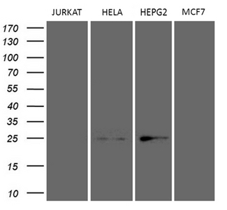 TSN / Translin Antibody - Western blot analysis of extracts. (35ug) from 3 different cell lines by using anti-TSN monoclonal antibody. (HepG2: human; HeLa: human; Jurkat: human; MCF7: human). (1:500)