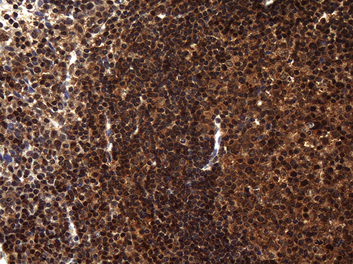 TSN / Translin Antibody - Immunohistochemical staining of paraffin-embedded Human tonsil within the normal limits using anti-TSN mouse monoclonal antibody. (Heat-induced epitope retrieval by 1mM EDTA in 10mM Tris buffer. (pH8.5) at 120°C for 3 min. (1:500)