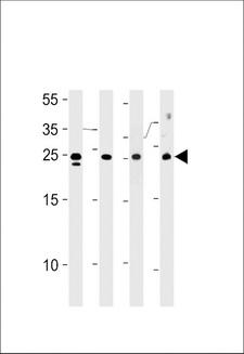 TSN / Translin Antibody - TSN Antibody western blot of HL-60,Jurkat,K562 cell line mouse spleen tissue lysates (35 ug/lane). The TSN antibody detected the TSN protein (arrow).