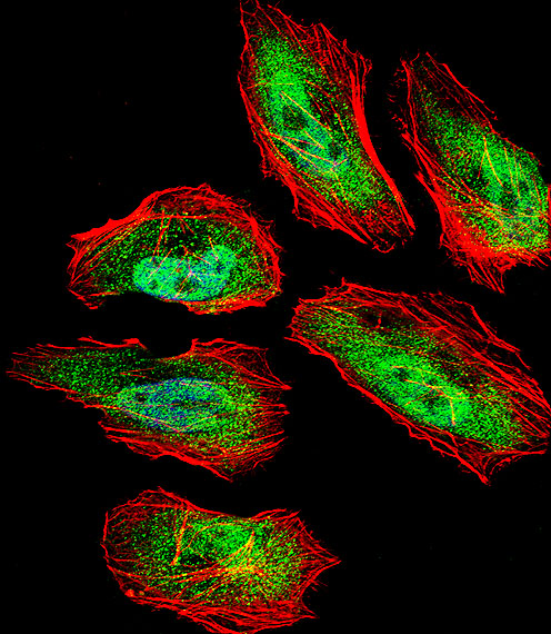 TSN / Translin Antibody - Fluorescent confocal image of HeLa cell stained with TSN Antibody. HeLa cells were fixed with 4% PFA (20 min), permeabilized with Triton X-100 (0.1%, 10 min), then incubated with TSN primary antibody (1:25, 1 h at 37°C). For secondary antibody, Alexa Fluor 488 conjugated donkey anti-rabbit antibody (green) was used (1:400, 50 min at 37°C). Cytoplasmic actin was counterstained with Alexa Fluor 555 (red) conjugated Phalloidin (7units/ml, 1 h at 37°C). Nuclei were counterstained with DAPI (blue) (10 ug/ml, 10 min). TSN immunoreactivity is localized to Nucleus and Cytoplasm significantly.
