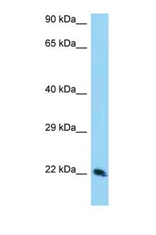 TSN / Translin Antibody - TSN / Translin antibody Western blot of 293T Cell lysate. Antibody concentration 1 ug/ml.  This image was taken for the unconjugated form of this product. Other forms have not been tested.