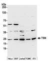 TSN / Translin Antibody - Detection of human and mouse TSN by western blot. Samples: Whole cell lysate (15 µg) from HeLa, HEK293T, Jurkat, mouse TCMK-1, and mouse NIH 3T3 cells prepared using NETN lysis buffer. Antibody: Affinity purified rabbit anti-TSN antibody used for WB at 0.1 µg/ml. Detection: Chemiluminescence with an exposure time of 3 minutes.