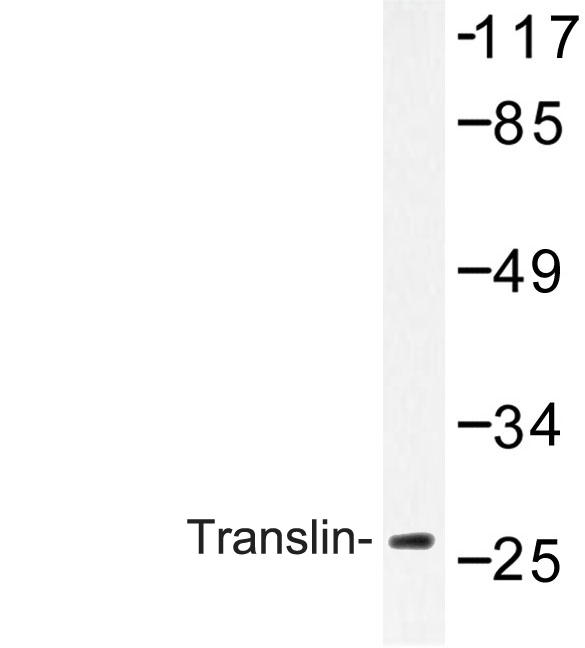 TSN / Translin Antibody - Western blot of Translin (E121) pAb in extracts from Jurkat cells.